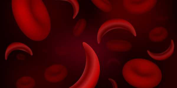 Sickle cell disease