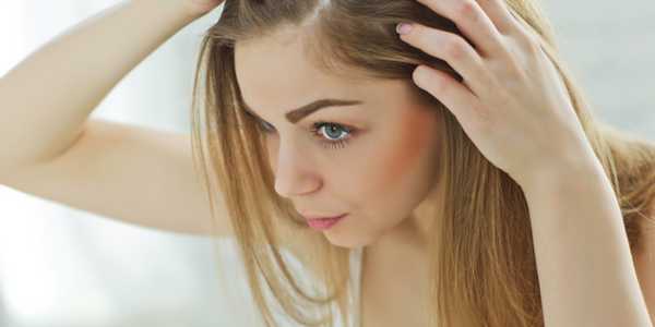 Hair loss and Alopecia