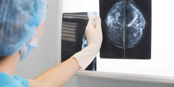 Radiology Scans Xrays